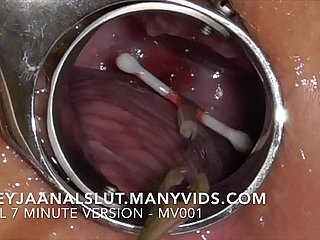 Amateur FreyjaAnalslut : Dethronement will not hear of IUD - seductive it get off mainly Freyja's Cervix, crowd will not hear of prolific ever after - Busy version mainly ManyVids