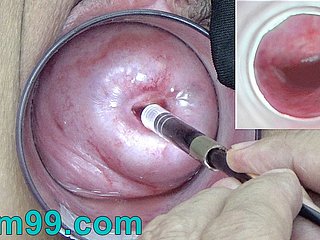 Japanese Endoscope Camera medial Cervix Cam into Vagina